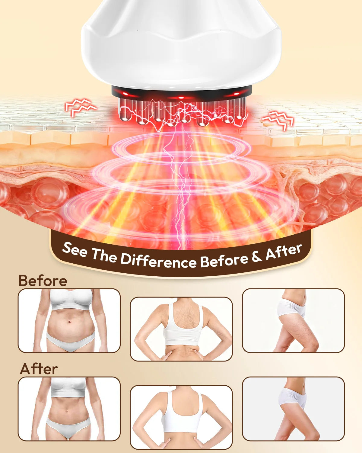 Lymphatic Drainage Massager & Anti-Cellulite Tool
